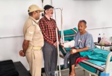 दून अस्पताल से लाइलाज रेफर हुए व्यथित राजू का, बर्न स्पेशलिस्ट हेल्पिंग हैंड्स यहां ऑपरेशन हुआ संपन्न