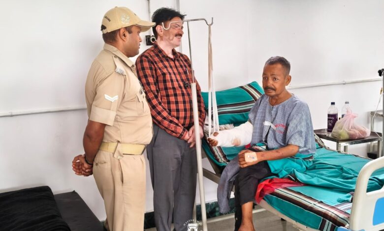 दून अस्पताल से लाइलाज रेफर हुए व्यथित राजू का, बर्न स्पेशलिस्ट हेल्पिंग हैंड्स यहां ऑपरेशन हुआ संपन्न