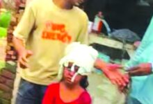 चोरी के दौरान बदमाशों ने बच्ची पर किया हमला, हालत गंभीर