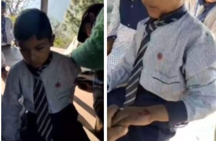 चमोली स्कूल परिसर में घुसा जंगली भालू, छात्र पर हमला, इलाके में दहशत
