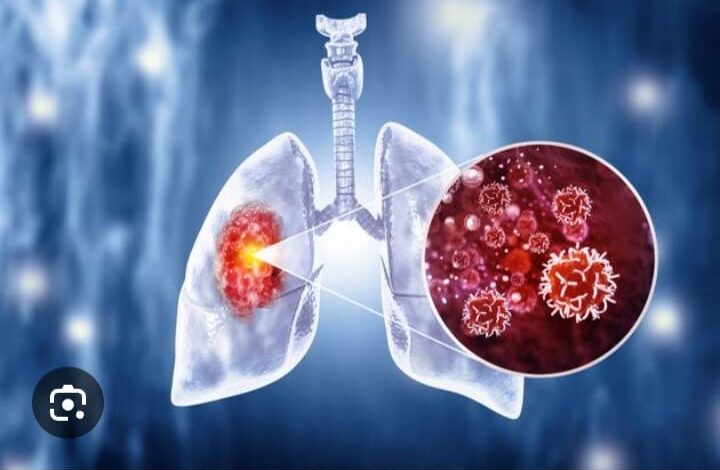 राजस्थान में कैंसर के बढ़ते मामलों का जल्द से जल्द निदान